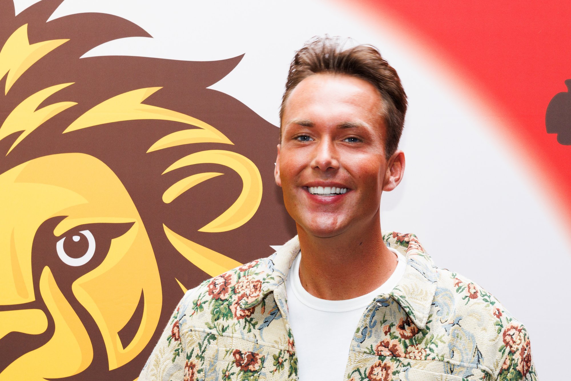 Nick Eshuis houdt litteken over aan val in Echte Jongens op Safari