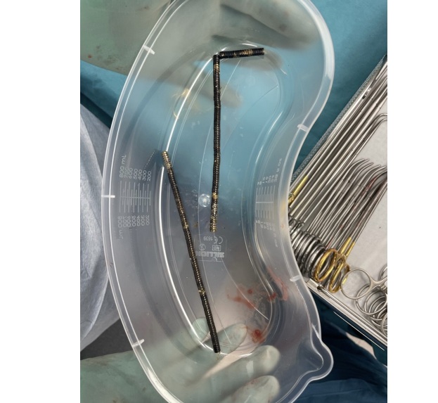 De magneetjes aan elkaar geklonterd.