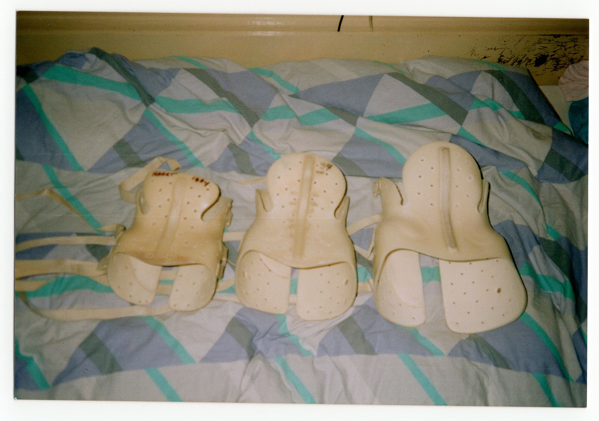 De korsetten die Femke in haar jeugd moest dragen.