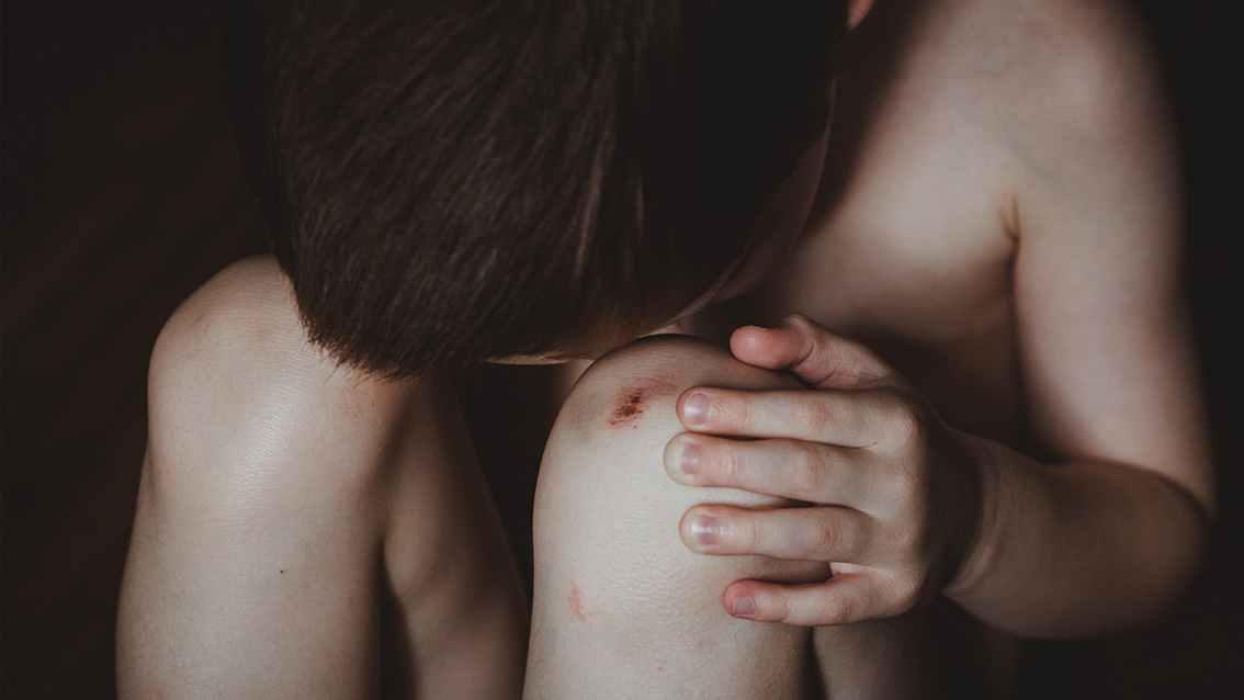 Pleegkinderen zwaar mishandeld en gebeten door hond: 'Mochten er niet over praten'