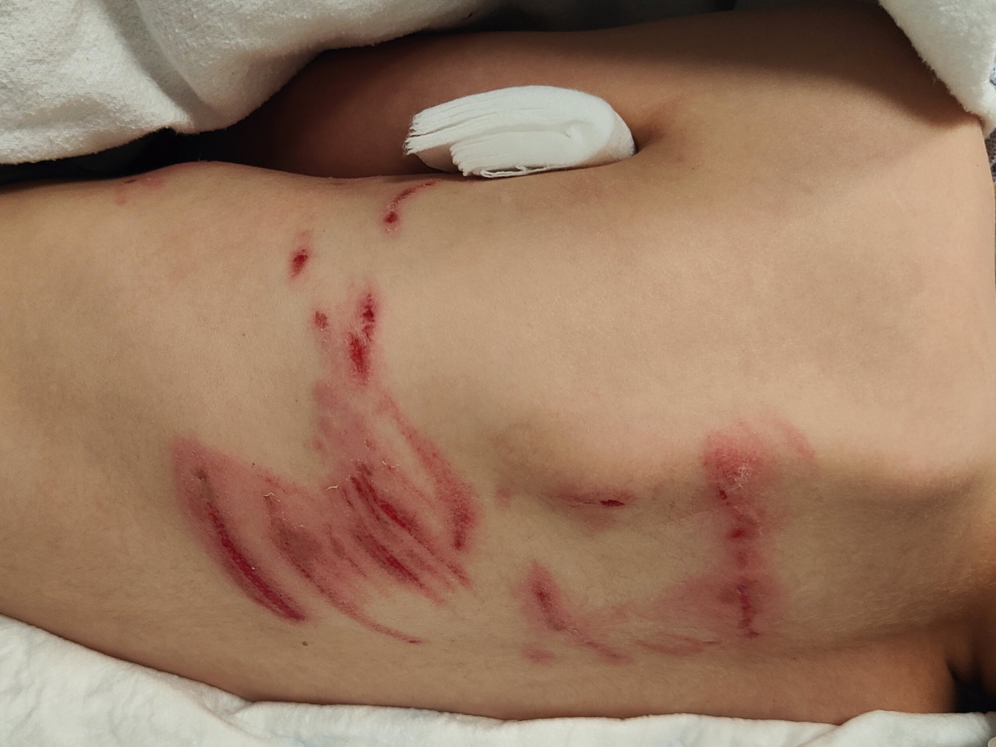 Wolf besprong kind vanaf bankje, zegt vader: 'Geweld nodig om te verjagen' 