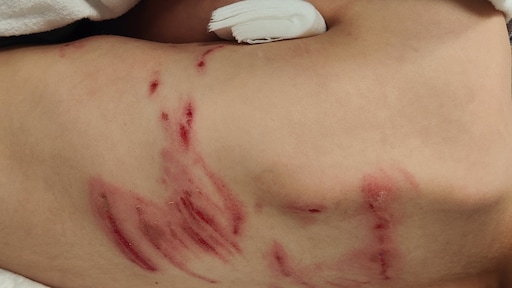 Wolf besprong kind vanaf bankje, vertelt vader: 'Geweld nodig om hem te verjagen'