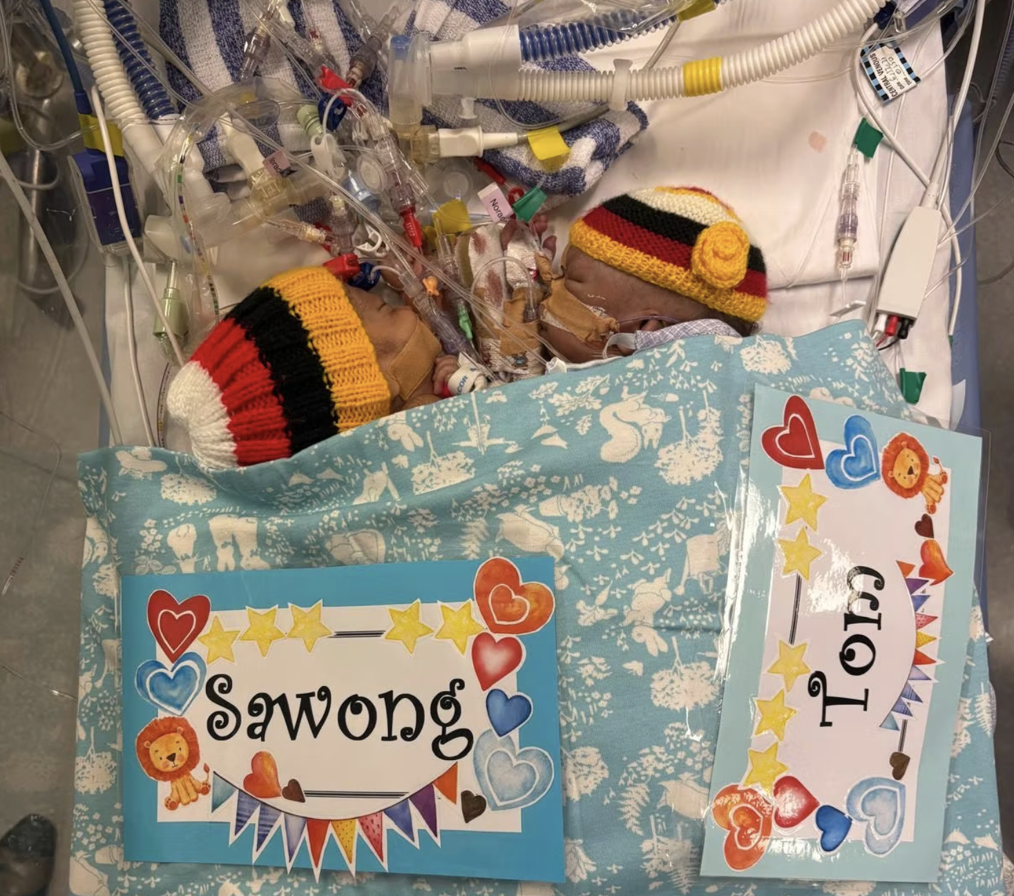 Tom rechts, heeft de operatie niet overleefd. 