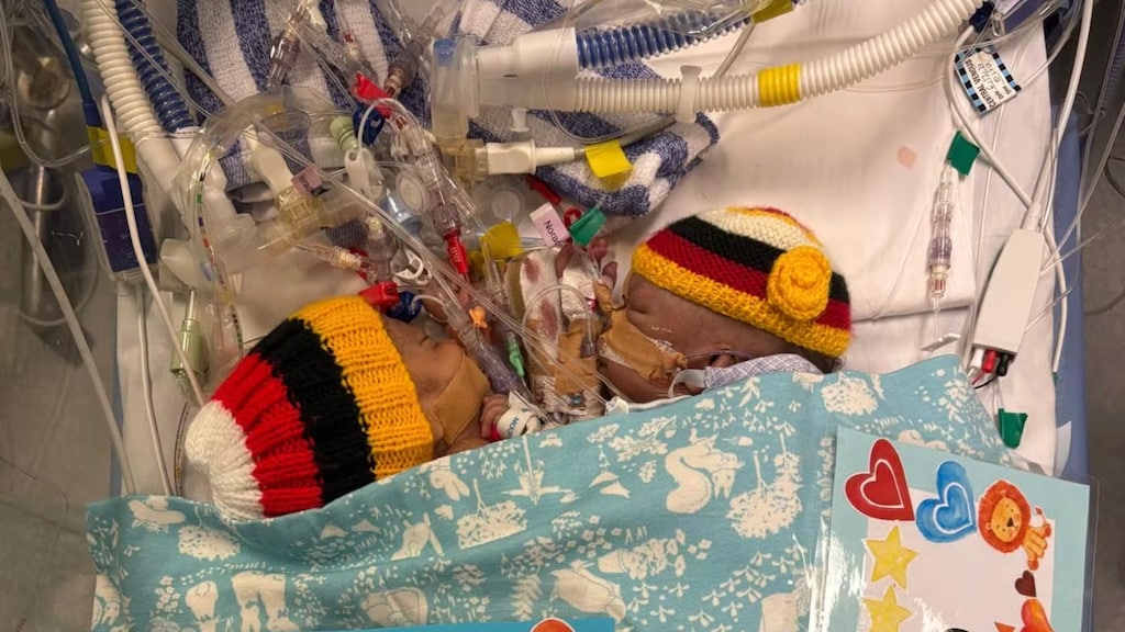 Tom rechts, heeft de operatie niet overleefd.