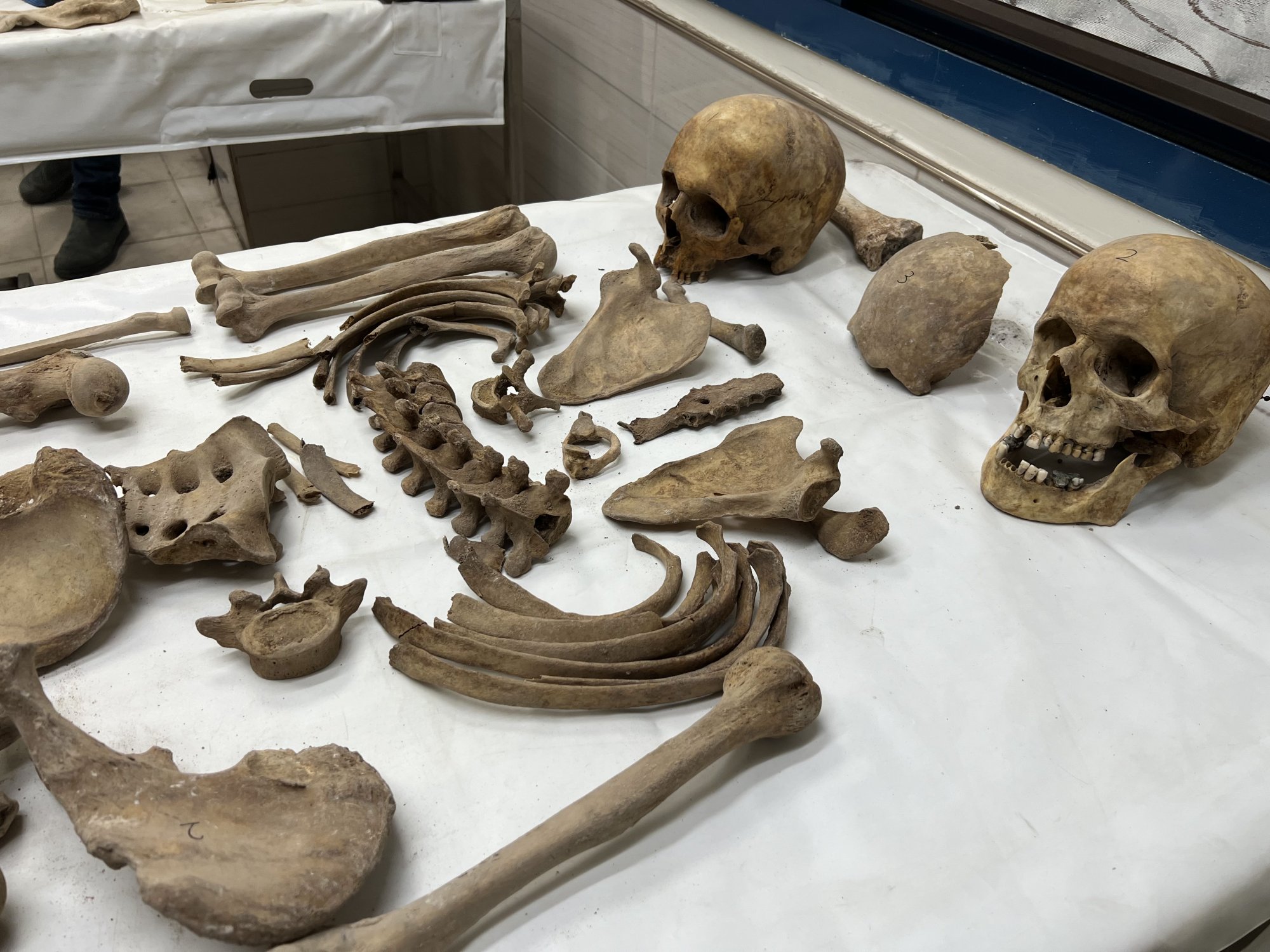 Een deel van de menselijke restanten dat in een massagraf werd gevonden.