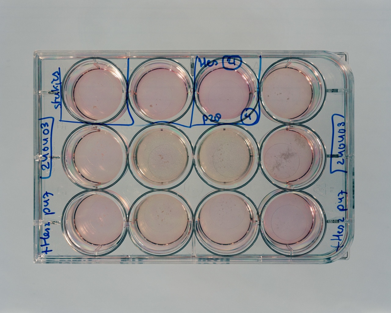 Meerderheid Tweede Kamer steunt wet die kweken embryo's mogelijk maakt