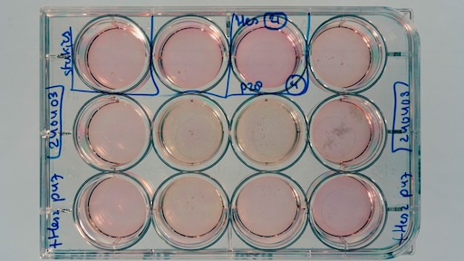 Meerderheid Tweede Kamer steunt wet die kweken embryo's mogelijk maakt