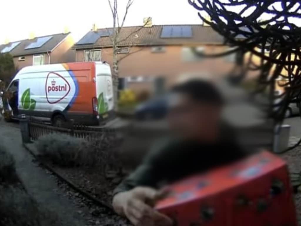 Risicovolle scheiding Siamese tweeling mislukt in Australië: baby Tom ...