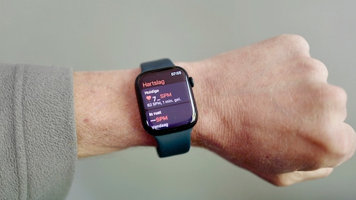 Smartwatch belangrijk hulpmiddel bij opsporen hartritmestoornis