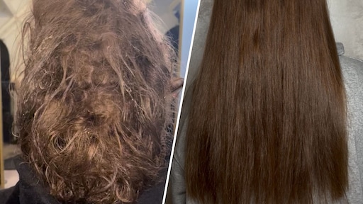 32 uur lang ontklitten: kapster herstelt Alicia's haar na langdurige coma