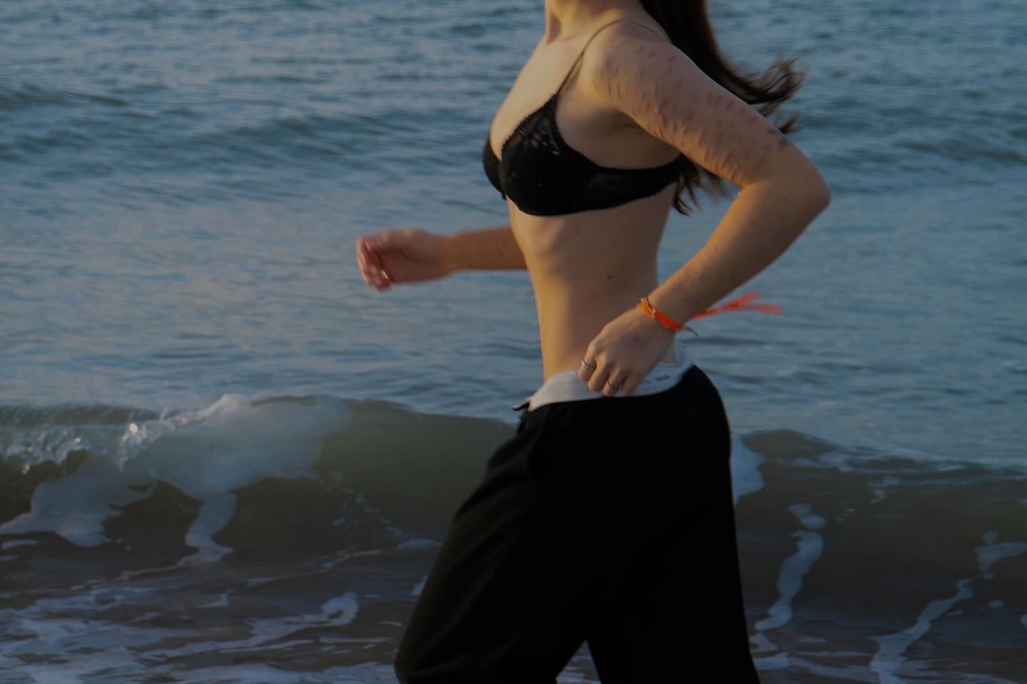 Juliëtte (20) beschadigde zichzelf: 'Word behandeld als exotische diersoort'