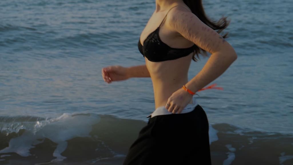 Juliëtte (20) beschadigde zichzelf: 'Word behandeld als exotische diersoort'