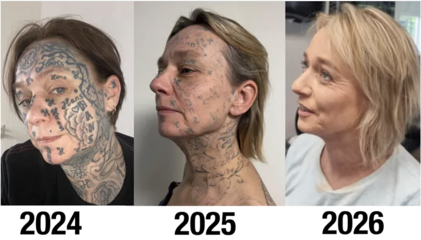 Jokes partner tatoeëerde 250 keer zijn naam op haar lichaam: 'Elke dag pijn'