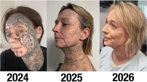 Jokes partner tatoeëerde 250 keer zijn naam op haar lichaam: 'Elke dag pijn'