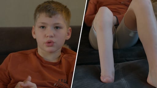 Sven de Lange (12) uit Een huis vol blijft positief na voetamputatie