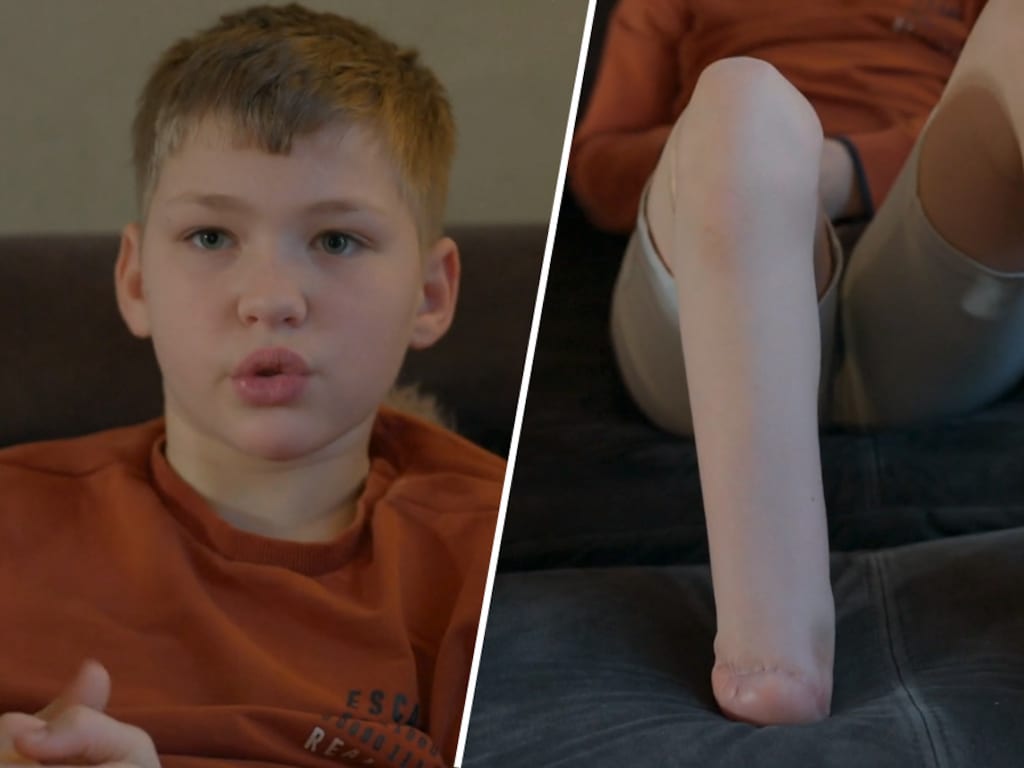 Sven de Lange (12) uit Een huis vol blijft positief na voetamputatie: 'Elk nadeel heeft zijn voordeel'