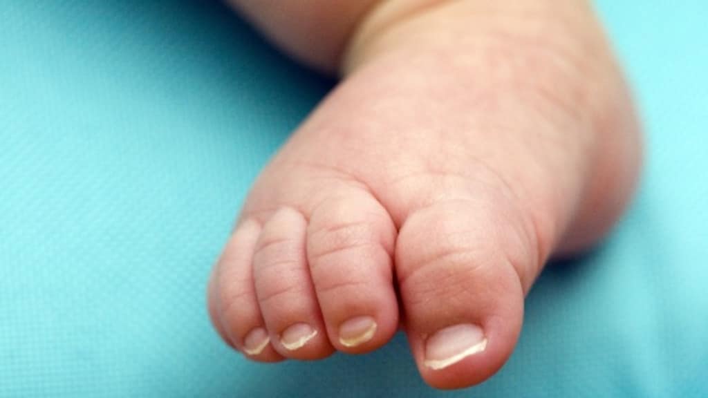 Niet genoeg zorg bij extreem vroeggeboren kinderen